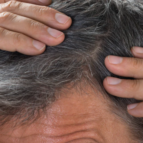 Shampoing en barre anti-pelliculaire - Unisexe - Image 3